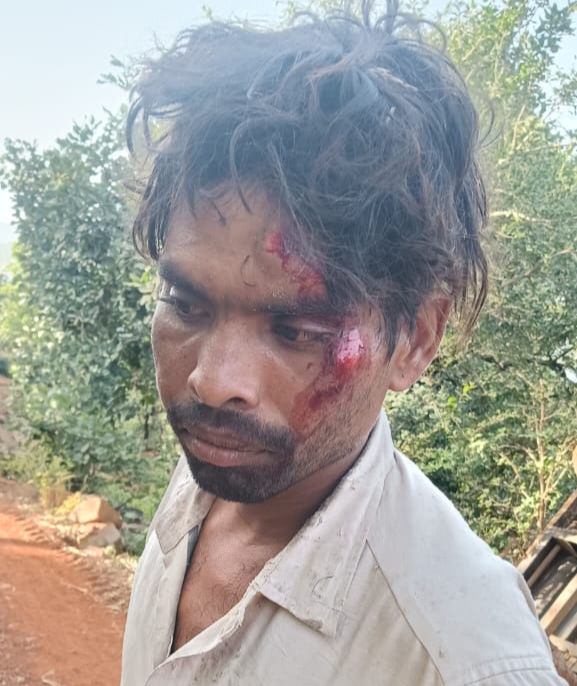 ड्राइवर किशन भील को आई हल्की चोटें 